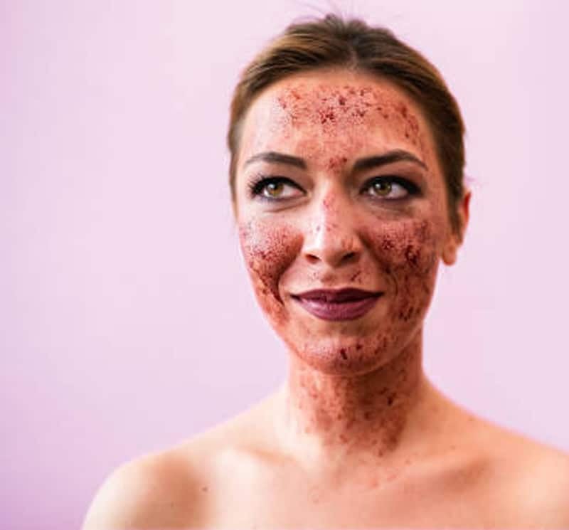 What is PRP Facial